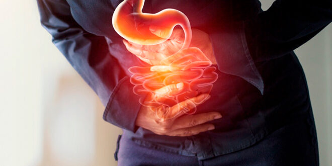 Cáncer de estómago