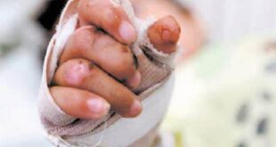 primera víctima de pólvora en Norte de Santander