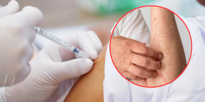 Cúcuta en máxima vigilancia por riesgo de sarampión